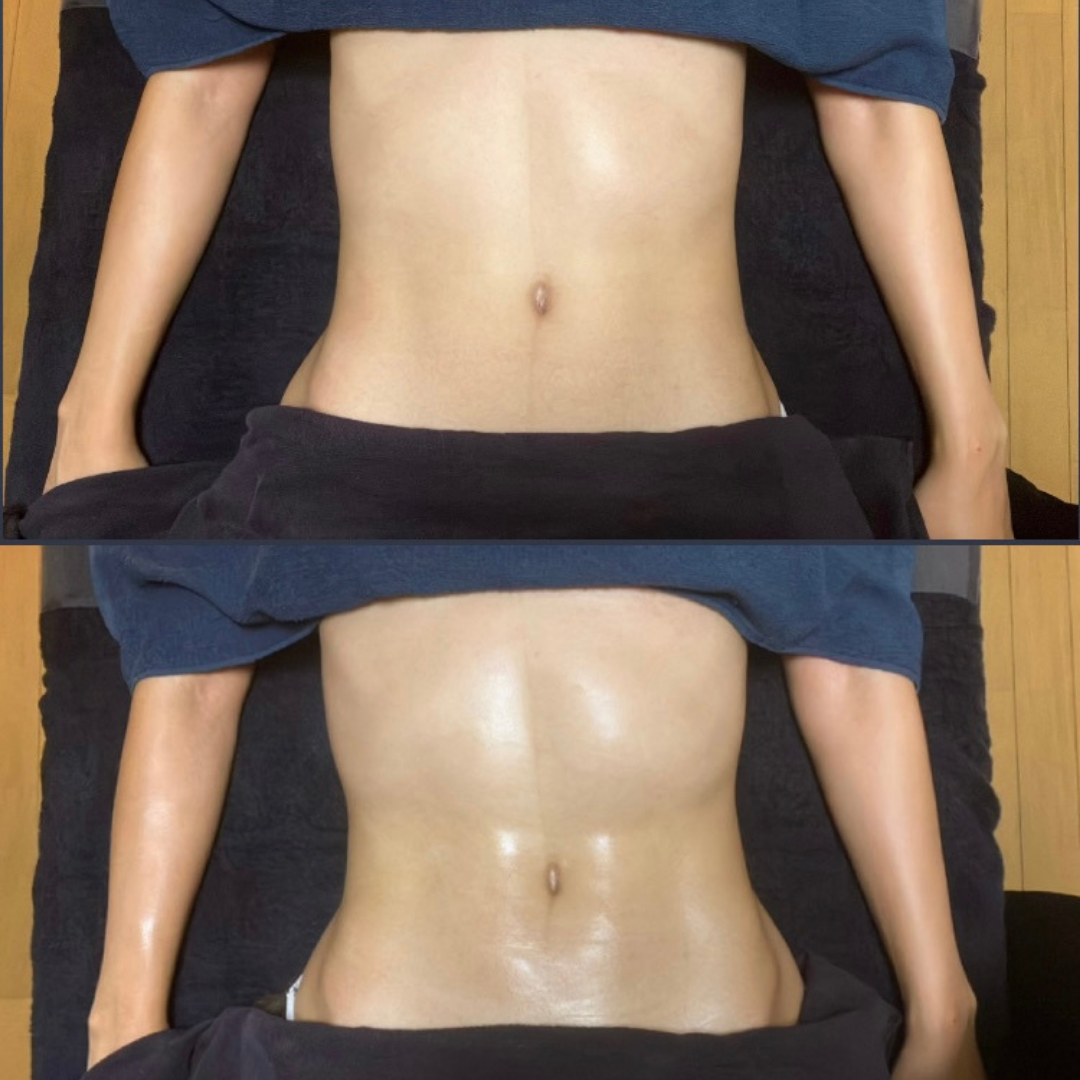 美腸活セラピー