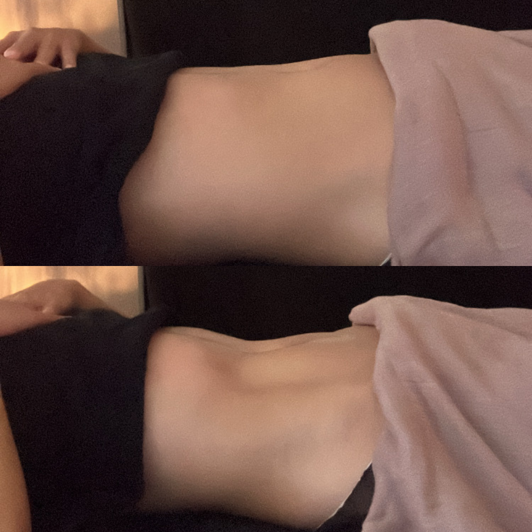 美腸活セラピー